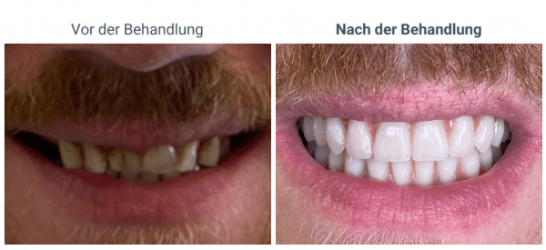 5-1024×469-1-600×275