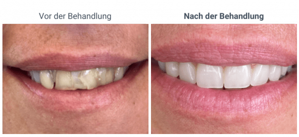 6-1024×469-1-600×275