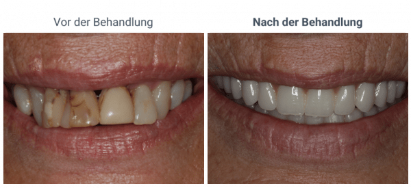 7-1024×469-1-600×275