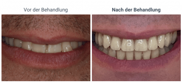 8-1024×469-1-600×275